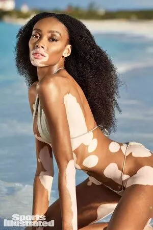 Winnie Harlow / winnieharlow nude photo #0105