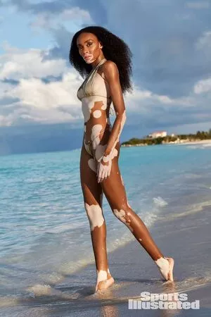 Winnie Harlow / winnieharlow nude photo #0106