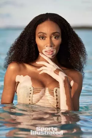 Winnie Harlow / winnieharlow nude photo #0108