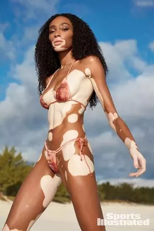 Winnie Harlow / winnieharlow nude photo #0110