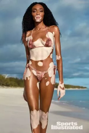 Winnie Harlow / winnieharlow nude photo #0111