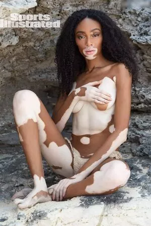 Winnie Harlow / winnieharlow nude photo #0114