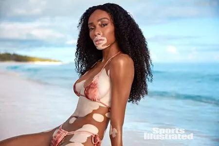 Winnie Harlow / winnieharlow nude photo #0115