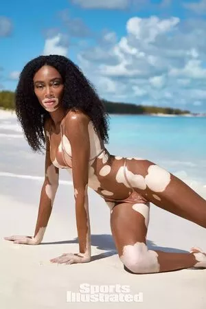 Winnie Harlow / winnieharlow nude photo #0117