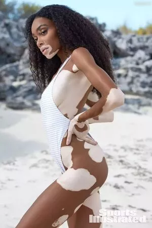 Winnie Harlow / winnieharlow nude photo #0122