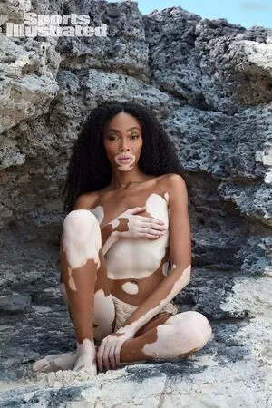 Winnie Harlow / winnieharlow nude photo #0125