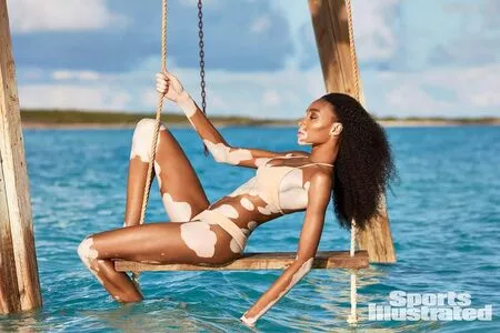 Winnie Harlow / winnieharlow nude photo #0131