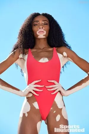 Winnie Harlow / winnieharlow nude photo #0137