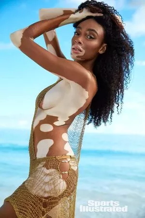 Winnie Harlow / winnieharlow nude photo #0140