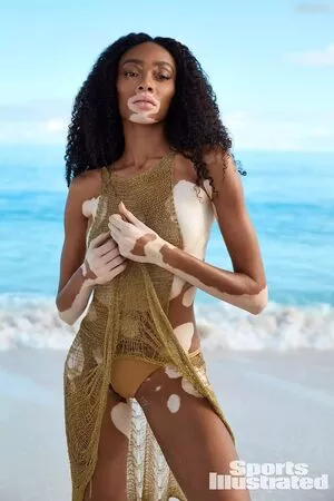 Winnie Harlow / winnieharlow nude photo #0141