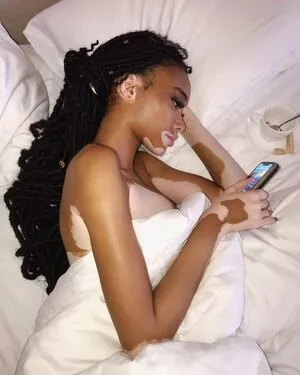 Winnie Harlow / winnieharlow nude photo #0159