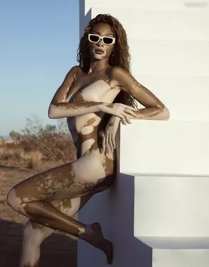 Winnie Harlow / winnieharlow nude photo #0161