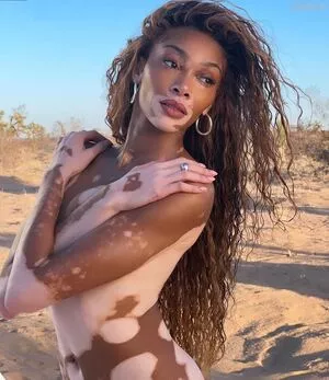 Winnie Harlow / winnieharlow nude photo #0163