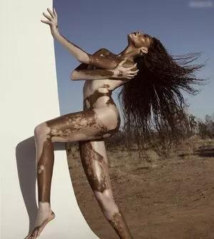 Winnie Harlow / winnieharlow nude photo #0165