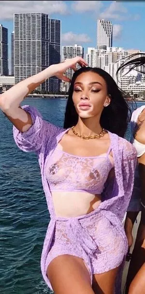 Winnie Harlow / winnieharlow nude photo #0199