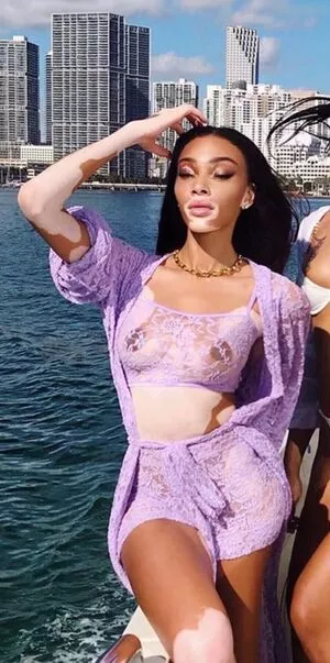 Winnie Harlow / winnieharlow nude photo #0205