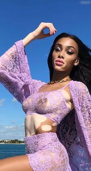 Winnie Harlow / winnieharlow nude photo #0210