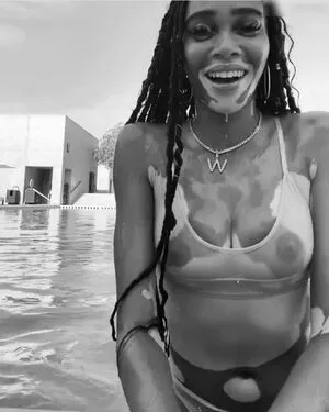 Winnie Harlow / winnieharlow nude photo #0212