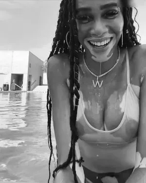 Winnie Harlow / winnieharlow nude photo #0215