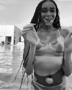 Winnie Harlow / winnieharlow nude photo #0216