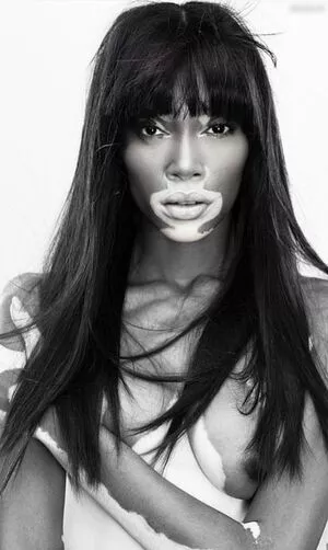 Winnie Harlow / winnieharlow nude photo #0219