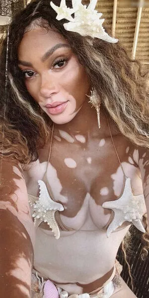 Winnie Harlow / winnieharlow nude photo #0346