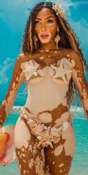 Winnie Harlow / winnieharlow nude photo #0347