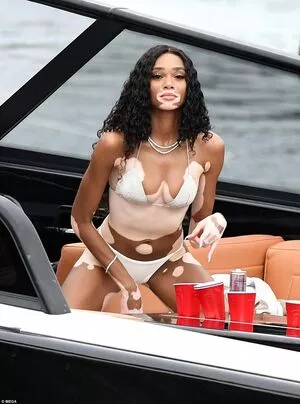 Winnie Harlow / winnieharlow nude photo #0368