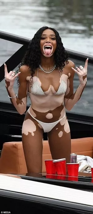 Winnie Harlow / winnieharlow nude photo #0371