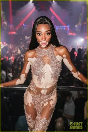 Winnie Harlow / winnieharlow nude photo #0372