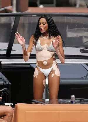 Winnie Harlow / winnieharlow nude photo #0375