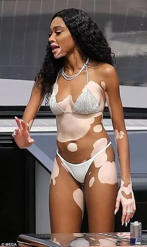 Winnie Harlow / winnieharlow nude photo #0376