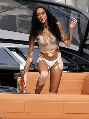 Winnie Harlow / winnieharlow nude photo #0380