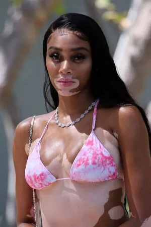 Winnie Harlow / winnieharlow nude photo #0413