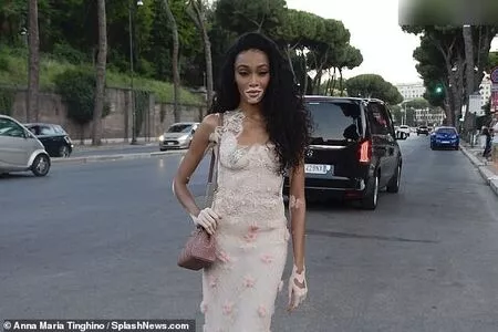 Winnie Harlow / winnieharlow nude photo #0434