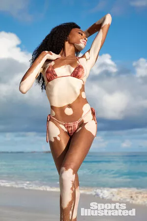 Winnie Harlow / winnieharlow nude photo #0441