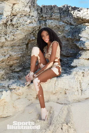 Winnie Harlow / winnieharlow nude photo #0442