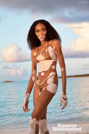 Winnie Harlow / winnieharlow nude photo #0452