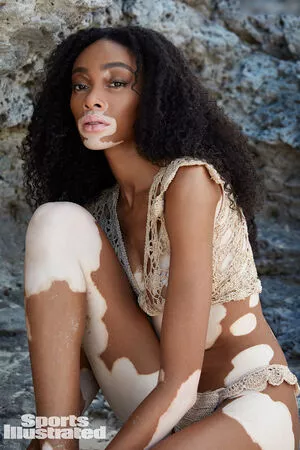 Winnie Harlow / winnieharlow nude photo #0455