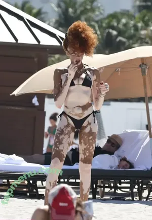 Winnie Harlow / winnieharlow nude photo #0505