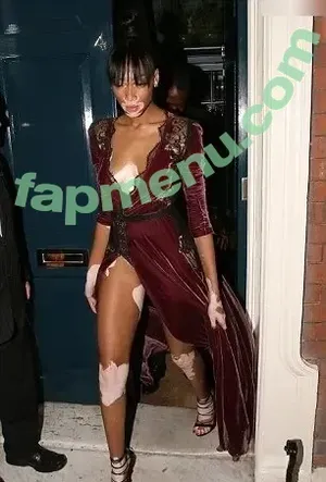 Winnie Harlow / winnieharlow nude photo #0519