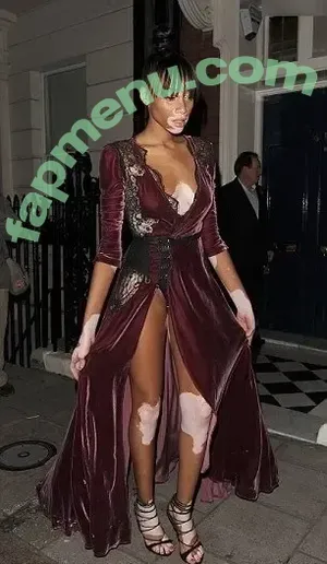 Winnie Harlow / winnieharlow nude photo #0521