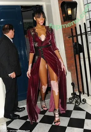 Winnie Harlow / winnieharlow nude photo #0524