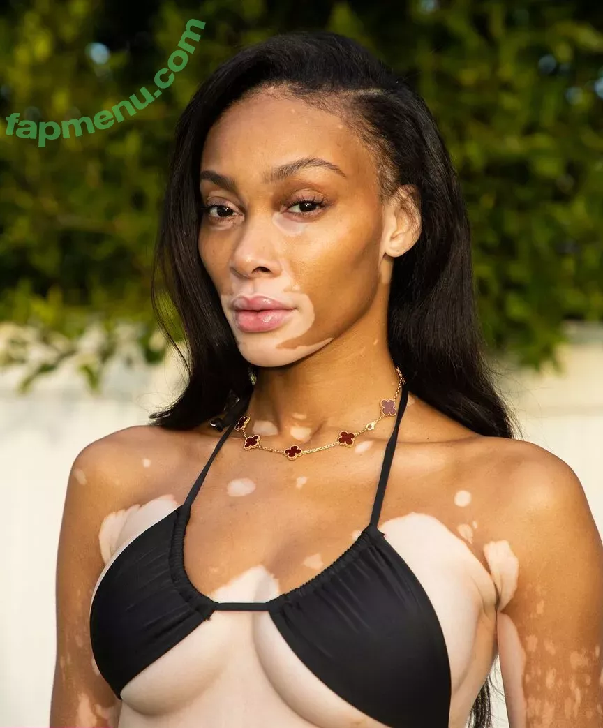 Winnie Harlow nude photo #0039 (winnieharlow)