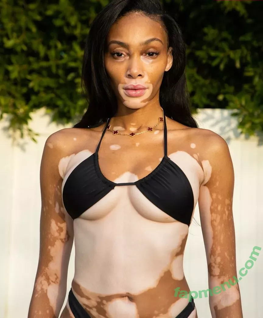 Winnie Harlow nude photo #0041 (winnieharlow)