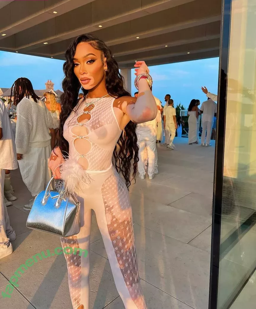 Winnie Harlow nude photo #0059 (winnieharlow)