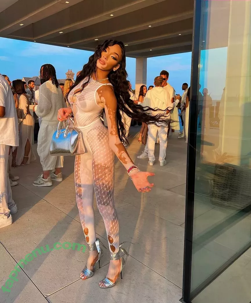 Winnie Harlow nude photo #0061 (winnieharlow)