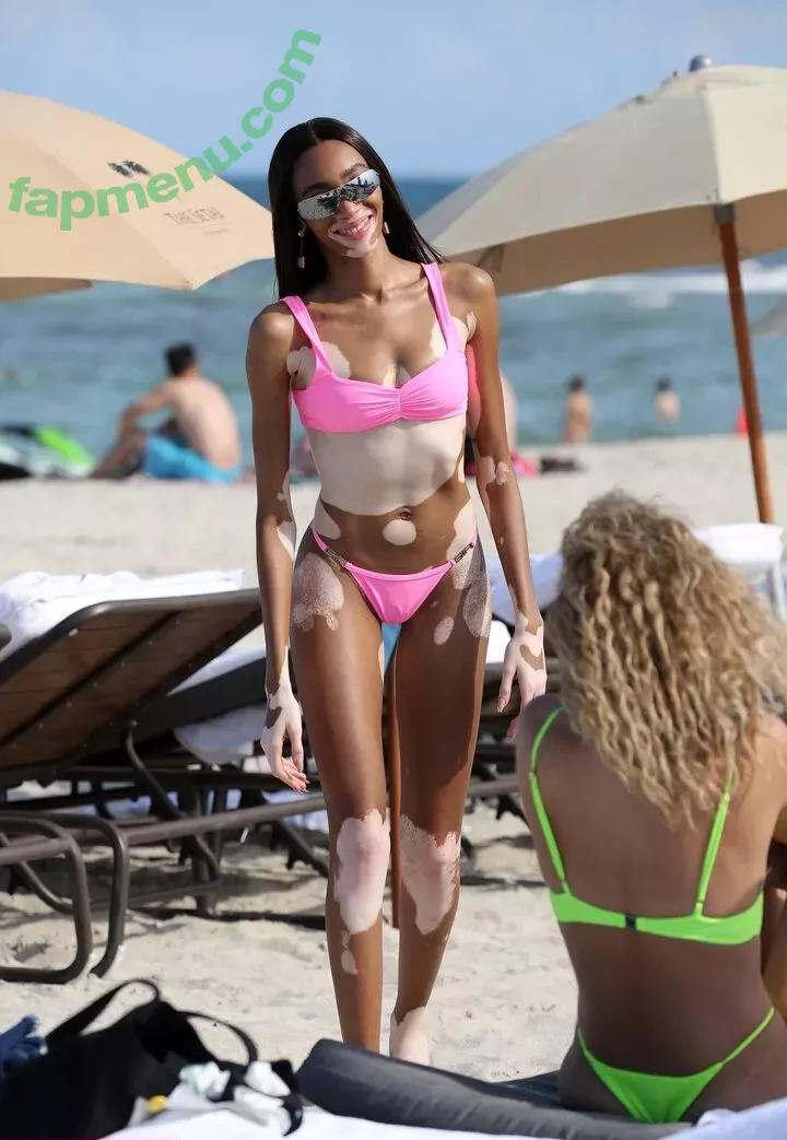 Winnie Harlow nude photo #0098 (winnieharlow)