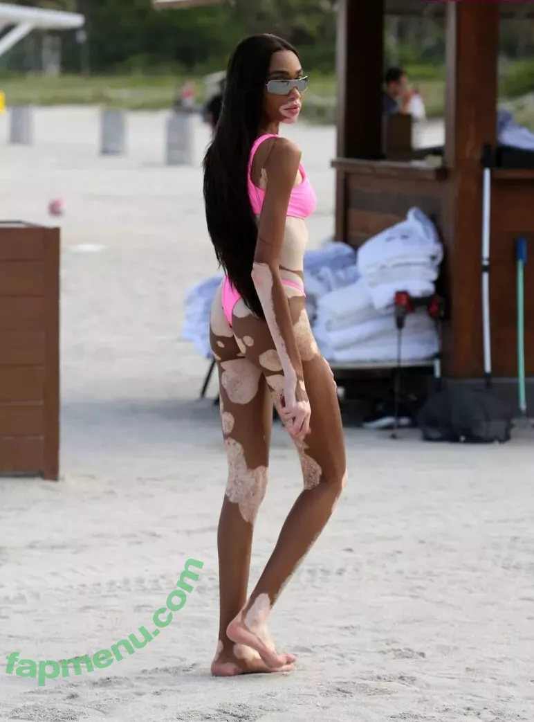 Winnie Harlow nude photo #0101 (winnieharlow)