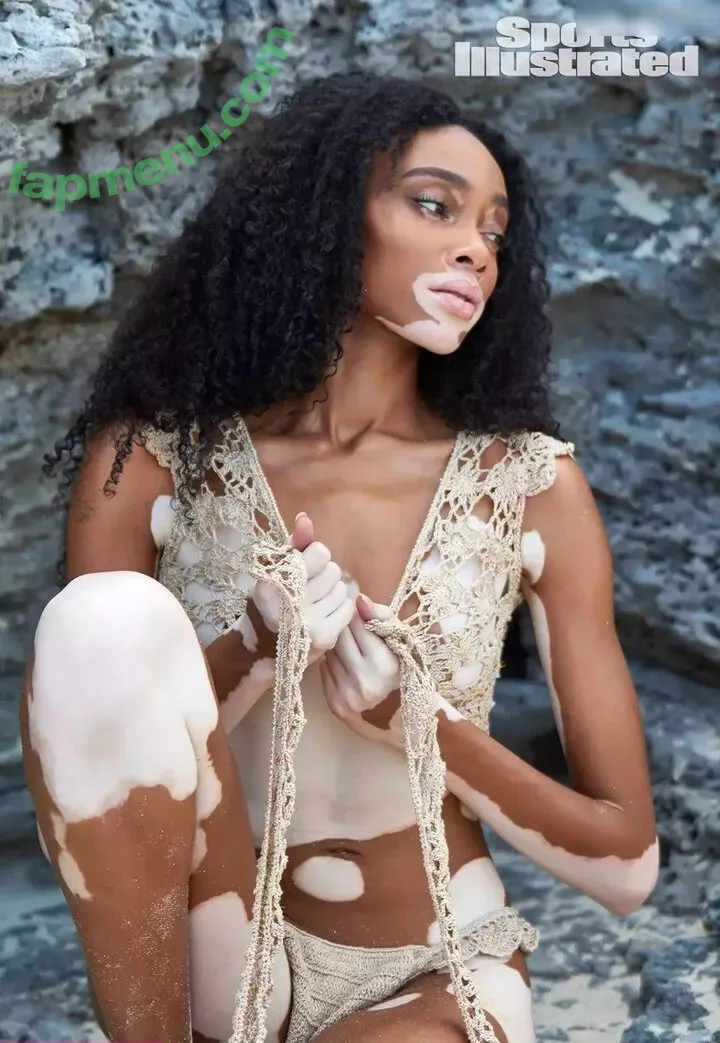 Winnie Harlow nude photo #0102 (winnieharlow)